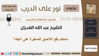 صورة ماحكم بقع اللاصق الصغيرة على الجلد؟ الشيخ الغديان - مشروع كبار العلماء