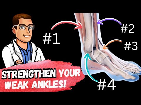 TOP 13 Ways to Shrink Bunions Naturally 1 HUGE SECRET