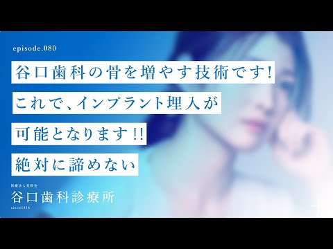 第80話 谷口歯科の骨を増やす技術です❗️-これで、インプラント埋入が可能となります‼️-絶対に諦めない❗️–札幌駅前-赤れんがテラス６階-谷口歯科診療所