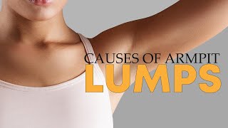 How To Treat Your Symptoms And Understand The Causes Of Armpit Lump | Tiggio