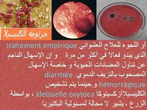 comment soigner rectocolite hemorragique