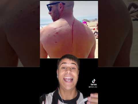 A Shark Attack Saved This Man's Life #shorts