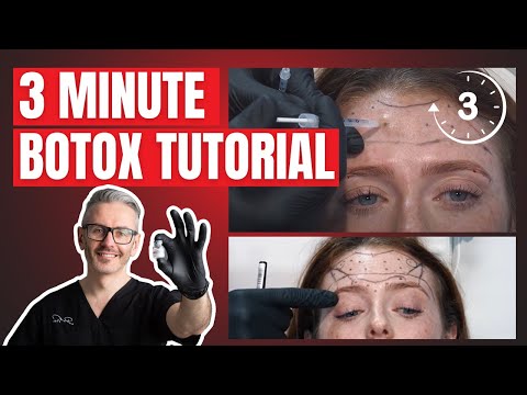 Simple Botox Tutorial | Common Botox Patterns | Botox Units Guide