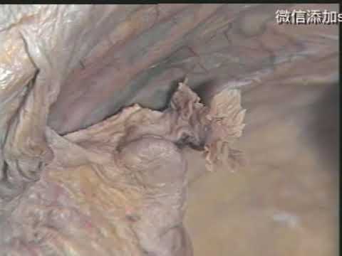 局部解剖学【女性盆腔脏器解剖】Regional anatomy [female pelvic organ anatomy] 