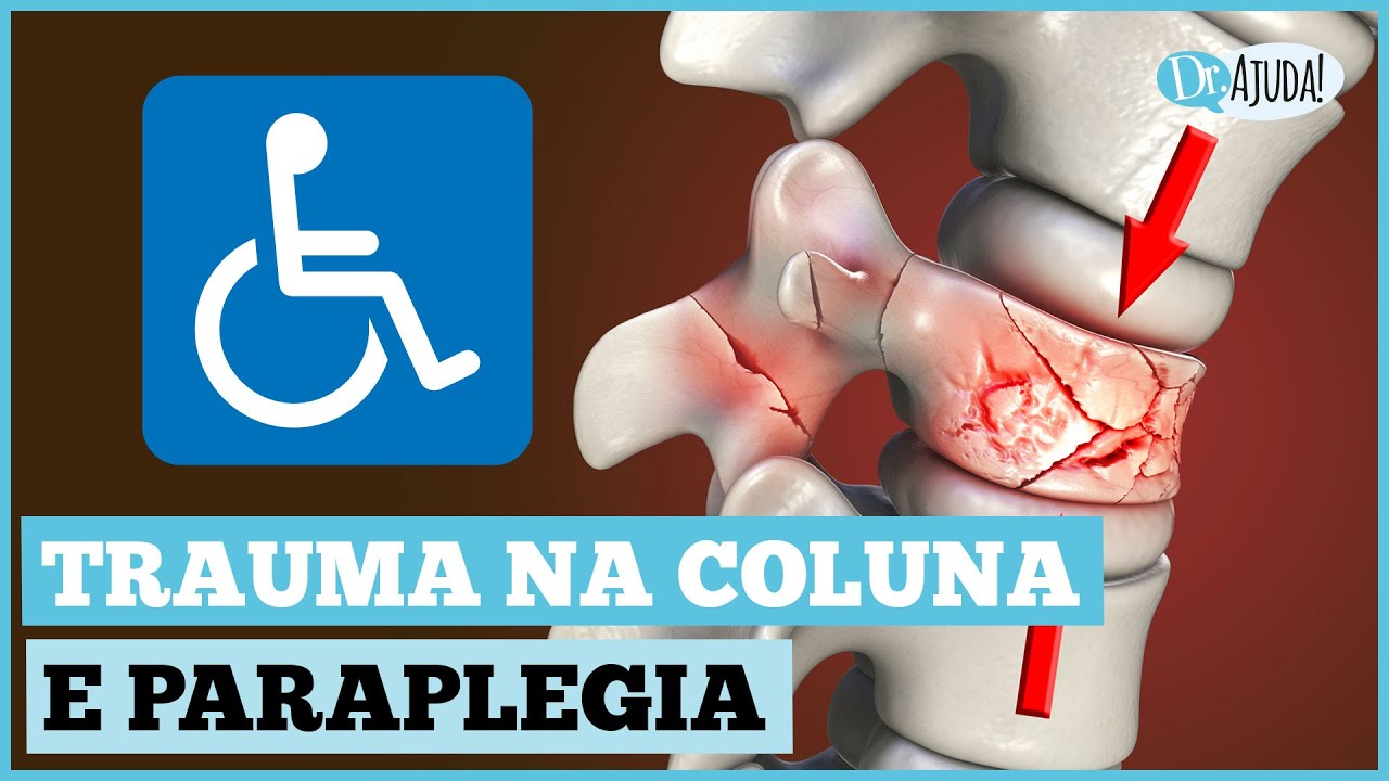 TRAUMA RAQUIMEDULAR: O QUE É ? O QUE FAZER ?