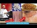 BARNOOTA FAYYAA KUTAA 78FFAA HABAKHAT