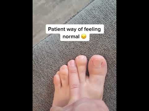 This toe can be fixed
