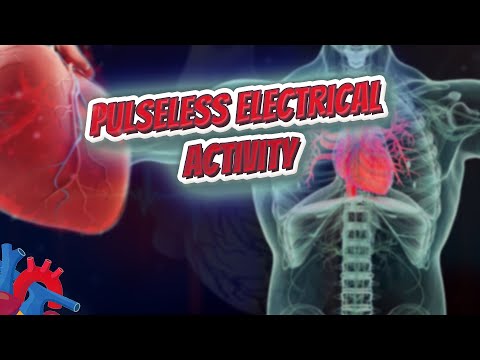Pulseless electrical activity - Human Heart and Cardiology ❤️❤️❤️🔊✅