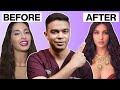 REVEALING Nora Fatehi S Cosmetic Surgery Secrets Doctor Reacts