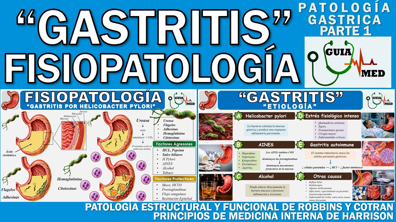 GASTRITIS POR HELICOBACTER PYLORI FISIOPATOLOGÍA | GuiaMed