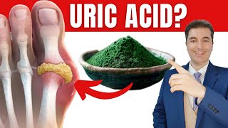 10 Simple Natural Remedies to Eliminate Excess Uric Acid