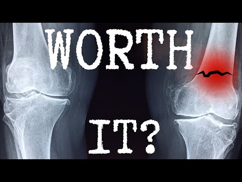 Should you wear Knee Braces for ADV & Dual Sport riding? | POD K4 2.0 Review