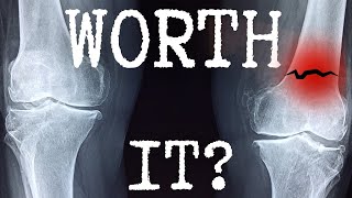 Should you wear Knee Braces for ADV & Dual Sport riding? | POD K4 2.0 Review