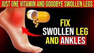Say Goodbye to Swollen Legs and Ankles with THIS 1 Vitamin! -  No More Swollen Legs and Ankles!