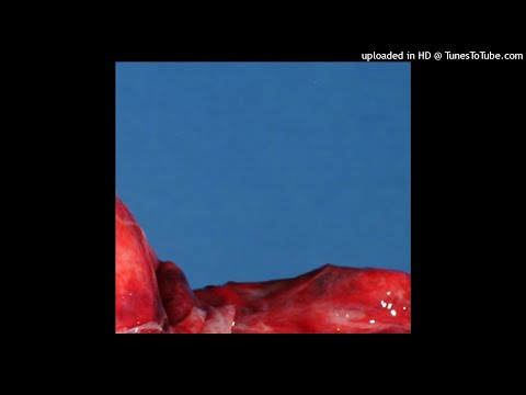 Soft Issues - Radiator Paint