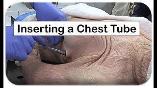 How to Insert a Chest Tube