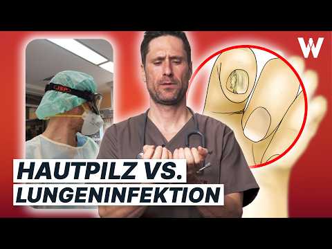 Pilzinfektionen: Enormes Problem und total unterschätzt! Das solltest Du ab jetzt wissen