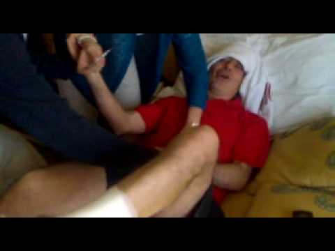 Ciò ginocchio osteofiti comune e il loro trattamento Tipi di giunti tbs