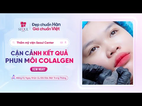 Xem Cận Cảnh: Từng Bước Phun Môi Collagen – Kết Quả Khiến Khách Hàng Phải Wow!