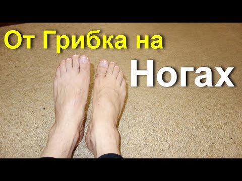 Ob gribok der Nägel auf der Hand übergeben wird Das Mittel von gribka zwischen