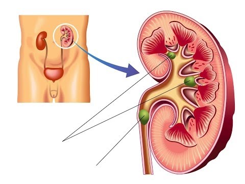 Innowell e-learning: Urinvejssystemet
