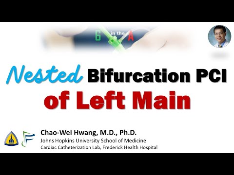 Nested Bifurcation Stenting of Left Main Trifurcation