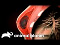 Infected Breast Implants Causes A Woman's Body to Shut Down | Monsters Inside Me | Animal Planet