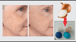 Natural recipe that is a million times stronger than Botox, eliminates wrinkles instantly
