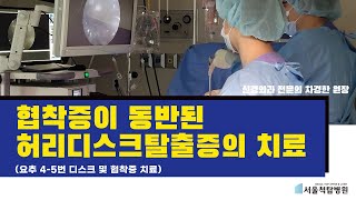 서울척탑병원, 협착증이 동반된 허리디스크탈출증(재업)