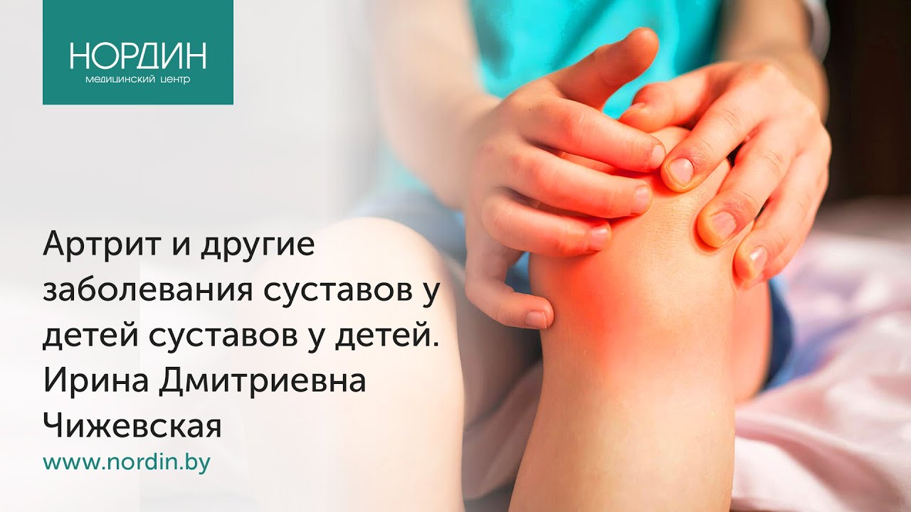 Артрит и другие заболевания суставов у детей, врач Ирина Чижевская