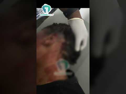 Viewer Discretion: Adwoa Safo Reportedly Injured After Incident After Shooting Incident