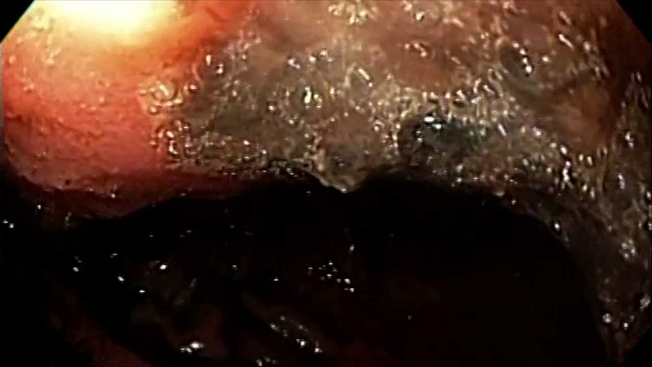 Adriana Fabiola Romano Munive-23