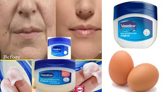 Remove Wrinkles From Face Naturally at Home / Get Rid of Deep Mouth Wrinkles using Vaseline and Egg