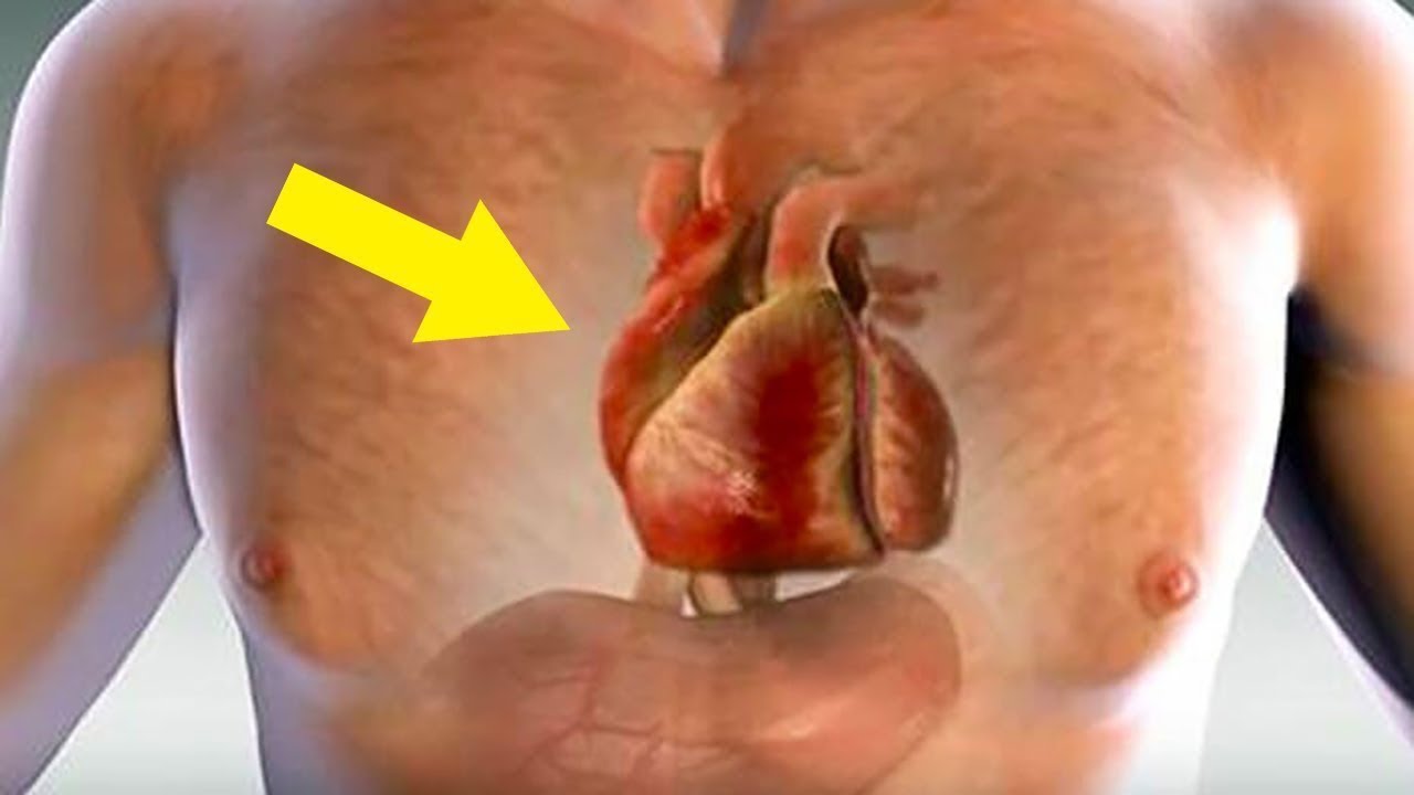 Watch Now Un Mese Prima Di Un Infarto, Il Tuo Corpo Ti Avvertirà - 14 Segni Premonitori Di Un Infarto Un Mese Prima Di Un Infarto, Il Tuo Corpo Ti Avvertirà - 14 Segni Premonitori Di Un Infarto
