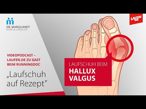 +++ Der richtige Laufschuh beim Hallux valgus – Laufschuh auf Rezept +++