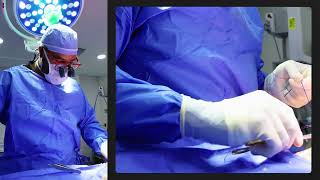 Thinking About a Tummy Tuck Here’s What to Expect with Dr. Triggs