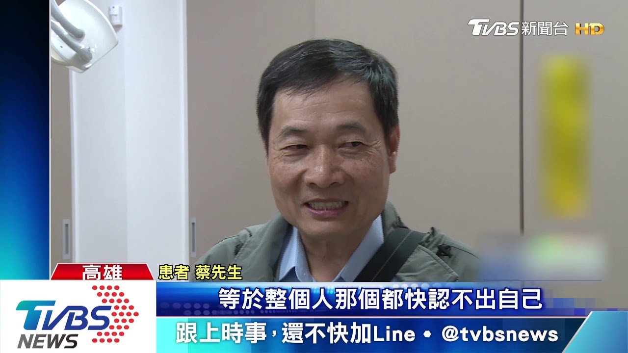 牙周病困擾10年拔19顆牙 患者得憂鬱症