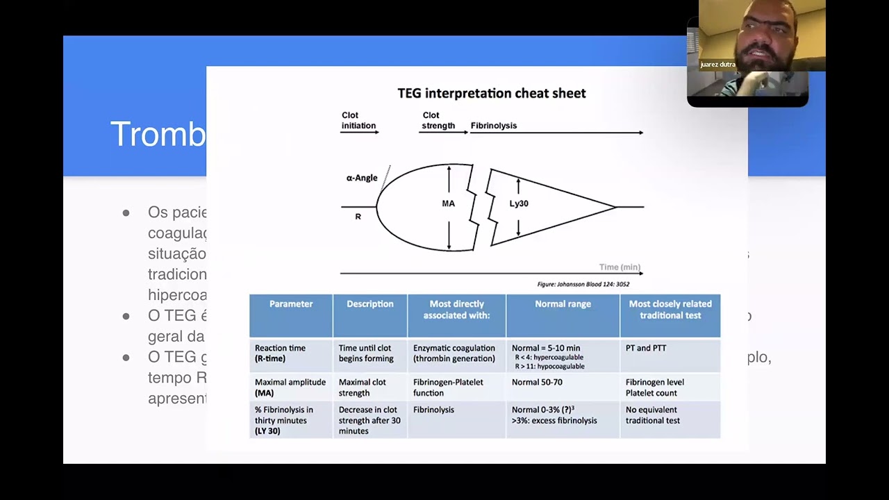 Coagulação Intravascular Disseminada