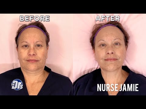 Carbon Facial on The Doctors with Nurse Jamie