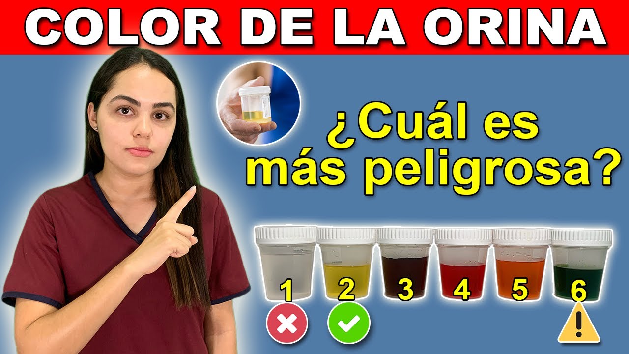 ¿Qué Significa El COLOR De Tu ORINA? - ¿ES SALUDABLE ORINAR TRANSPARENTE?
