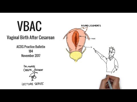 download lagu mp3 mp4 Vbac Tips In Hindi, download lagu Vbac Tips In Hindi gratis, unduh video klip Vbac Tips In Hindi