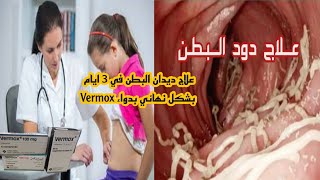 علاج ديدان البطن في 3 ايام بشكل نهائي بدواء Vermox