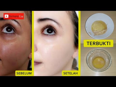 download lagu mp3 mp4 Tips Wajah Putih Tanpa Jerawat, download lagu Tips Wajah Putih Tanpa Jerawat gratis, unduh video klip Tips Wajah Putih Tanpa Jerawat