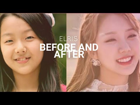 ELRIS Before and After