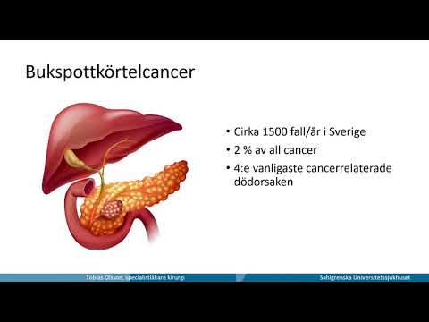 Krirgveckan 2021 Göteborg. Pankeascancer.