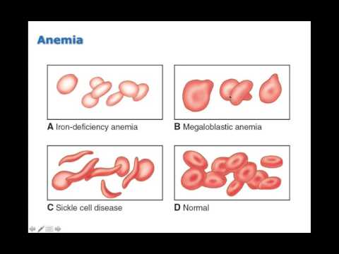 Chapter 13 Disorders of Red Blood Cells BIO216
