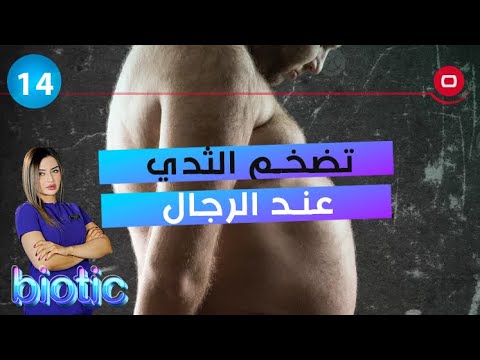 شاهد بالفيديو.. تضخم الثدي عند الرجال - م٣ Biotic - الحلقة ١٤