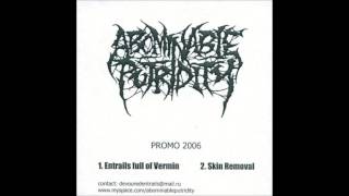Abominable Putridity - Skin Removal (HQ)