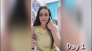 TCA Peeling Uygulaması Ve Sonrası (Dikkat mizah içermez!)