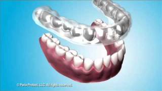 Treating Gum Disease with the Perio Protect Method
